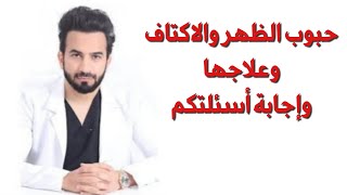 حبوب الظهر والاكتاف وعلاجها وإجابة أسئلتكم  دكتور طلال المحيسن [upl. by Aelanna872]