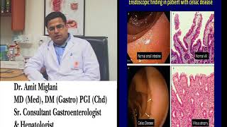 what is Celiac Disease [upl. by Greerson]