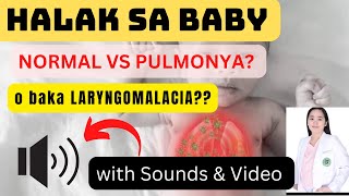 PULMONYA ba ang HALAK Causes of HALAK in BABY Dr Pedia Mom [upl. by Doi406]