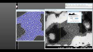 How to use ImageJ for nanoparticle size distribution analysis [upl. by Ruelu539]