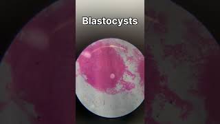 TS of ovary  TS of testis  ringworm bacteria under microscope biology animalkingdomclass11 [upl. by Olney]