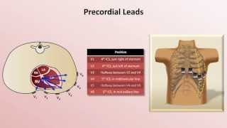 Intro to EKG Interpretation  EKG Leads [upl. by Patman628]