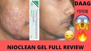 Nioclean Gel Full Review Your Ultimate Acne Warrior चमकती त्वचा का राज़ 💖 AcneFreeMagic 🌟quot [upl. by Eleen]