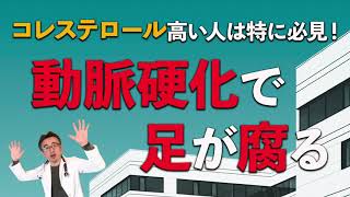 【動脈硬化】足が腐る原因とセルフチェック法【千葉県船橋市すぎおかクリニック／杉岡充爾】 [upl. by Amiaj]