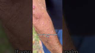 Mango Worm Parasite How do you remove them shorts florida mangoworms [upl. by Biondo]