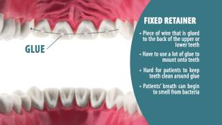 Types of Retainers  Retainer Wear Part 2 [upl. by Ennagroeg587]