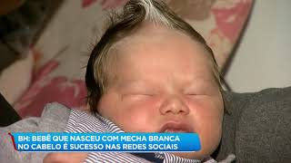 Bebê que nasceu com mecha branca no cabelo faz sucesso na internet [upl. by Darian]