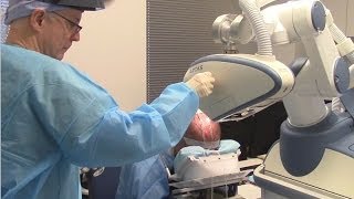 Robotic Hair Transplant Recipient Site Creation with the ARTAS FUE Robot [upl. by Ttnerb]