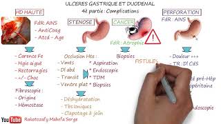 ULCÈRES GASTRIQUE ET DUODÉNAL  4è Partie  Complications [upl. by Bekelja510]