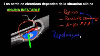 CURSO DE EKG 32  ELECTROCARDIOGRAFÍA DE LA CARDIOPATÍA ISQUÉMICA  INTRODUCCIÓN CLÍNICA [upl. by Job]