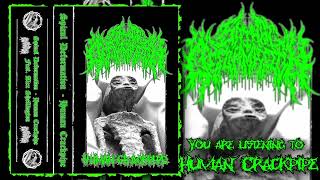 Spinal Deformation  Human Crackpipe Single  Slamming Brutal Death Metal [upl. by Africah]