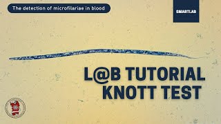 How to detect microfilariae in blood The Knott test  SMARTLAB [upl. by Aniala]