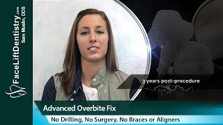 Receding Chin Misaligned Jaw Corrected in 2Weeks [upl. by Rehpotsrihc]