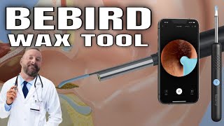 Bebird Ear Wax Removal Tool  Ear Cleaning Wax Removal [upl. by Yseult47]