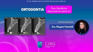 Área hipodensa associada ao dente 13  Caso Clínico com a Dra Mayara Viandelli [upl. by Garaway567]