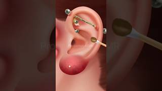 Ear cleaning ASMR treatment  asmr earcleaning earcleaningasmr shorts [upl. by Collins477]