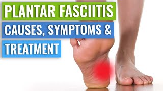 Plantar Fasciitis Causes Symptoms amp Treatment [upl. by Nadoj]