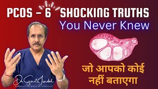 PCOS EXPERT Reveals 6 Shocking Truths You Never KnewDr Sunil JindalJindal Hospital Meerut [upl. by Killam]