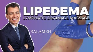 Manual Lymphatic Drainage Massage after Lipedema Surgery  Salameh [upl. by Anrim529]