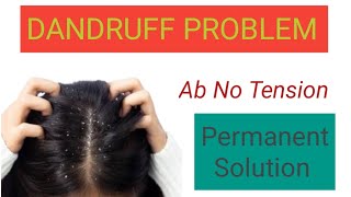 DANDRUFF PROBLEM  Home remedies [upl. by Gabriela]