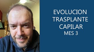 Evolución Trasplante capilar en Turquía  3 meses [upl. by Nosahc]