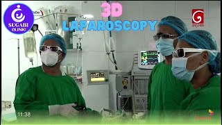 3D Laparoscopy Breakthrough with Dr Chaminda Mathota at Leesons Hospital Ragama [upl. by Ttennaej]