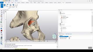 Automatic Acetabular Cup Placement Script [upl. by Anerrol]