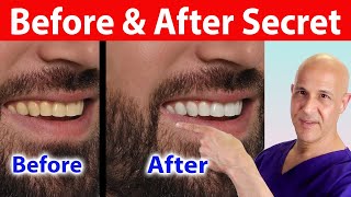 This Secret Fruit Whitens Teeth Instantly—You’ll Be Amazed Dr Mandell [upl. by Irianat704]