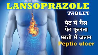 Lansoprazole Orally Disintegrating Tablets 30mg Review In Hindi  Junior Lanzol 30mg Tablets Uses [upl. by Giarla]