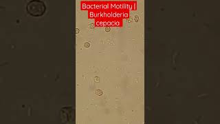 Bacterial Motility Burkholderia cepacia Blood Culture bacteremia [upl. by Drusie48]