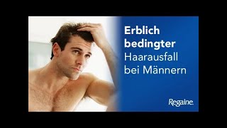 Erblich bedingter Haarausfall bei Männern Dr Kerstin Neumann von REGAINE® [upl. by Novert471]