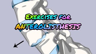 Exercises for ANTEROLISTHESIS [upl. by Merlina]