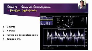 EPISÓDIO 16  Fluxo Mitral [upl. by Ahtenak949]