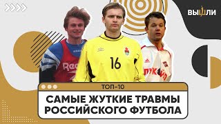 ТОП10  Самые страшные травмы в истории российского футбола [upl. by Weiner936]