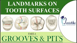 Landmarks on tooth surfaces Part4 GROOVES  PITS  Terminology  Tooth landmarks  Dental Anatomy [upl. by Demaria]