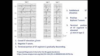 Diagnosis of Brugada in a nutshell Arabic Version [upl. by Alveta]