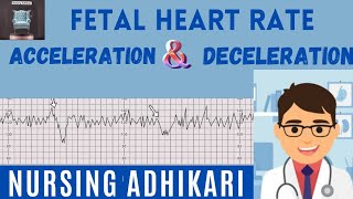 DECELERATION OF FETAL HEART RATE Early  Late and variable Acceleration ।। Mnemonic VEAL CHOP ।। [upl. by Yvon543]