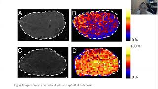 Desorption electrospray ionization mass spectrometry Imaging drugs and metabolitesin tissuesquot [upl. by Oregolac]