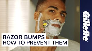 Want to Prevent Razor Bumps Learn How to Minimize Ingrown Hairs  Gillette [upl. by Rentsch]