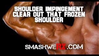 Shoulder Impingement Syndrome Yeah Do This  Trevor Bachmeyer  SmashweRx [upl. by Veljkov]