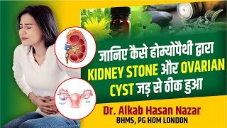 How Homeopathy Cured Her Kidney Stone and Ovarian Cyst in Just Weeks  Dr Nazar Homeopathy  Kanpur [upl. by Ardet773]