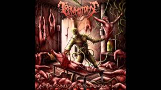 Traumatomy  Transformation Into A Putrid Mass 2013 FullEP [upl. by Ysiad]