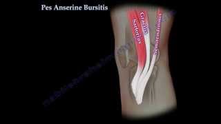 Pes Anserine Bursitis  knee pain  Everything You Need To Know  Dr Nabil Ebraheim [upl. by Arihsan967]