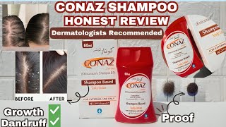 CONAZ SHAMPOO HONEST REVIEW  BEST ANTIDANDRUFF SHAMPOO [upl. by Cimah]