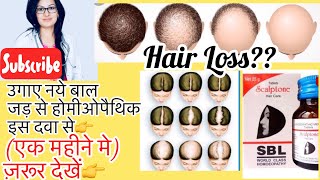 Scalptone—Best Homeopathic Medicine for baldnessसकल्पटोन Hair Fall Baldness Alopecia Dr Rukmani [upl. by Isyad313]