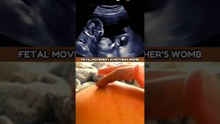 Fetal Movement in Mothers Womb 💕😍 ultrasound scan fetus [upl. by Kimon642]