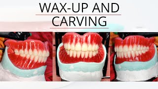 Wax up Carving and feestoning complete denture [upl. by Mercier]