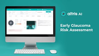 AI for Glaucoma Early Risk Assessment on OCT [upl. by Nyleikcaj]