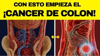 Las 10 PRIMERAS SEÑALES de CÁNCER DE COLON que nunca debes ignorar [upl. by Amhsirak]