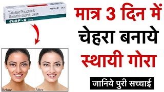 गोरे क्यों हो रहे है लोग ये क्रीम Use करके  Clop  G Cream Review  Clop G cream Usages amp Benefits [upl. by Tychon636]